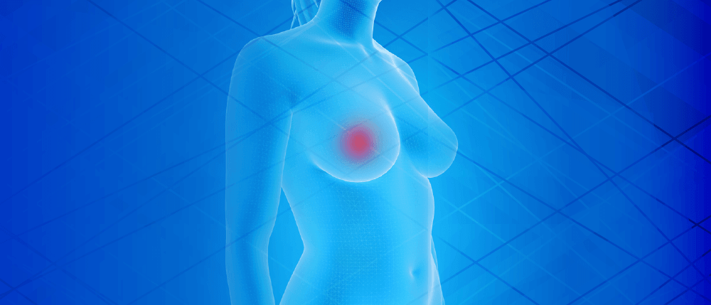 Short comments: Breast Cancer risk in trans women